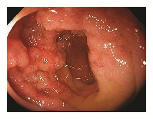 Details are in the caption following the image Details are in the caption following the image
