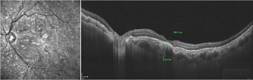 Details are in the caption following the image
