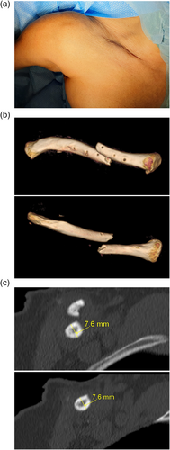 Details are in the caption following the image