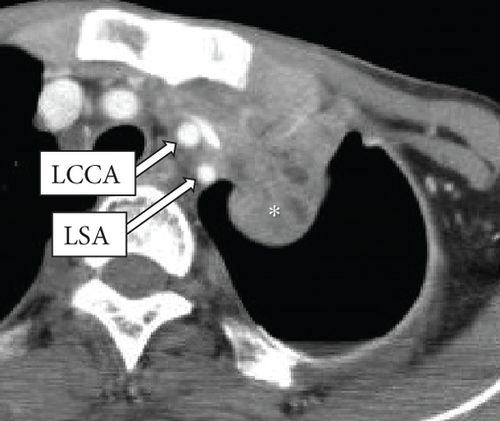 Details are in the caption following the image