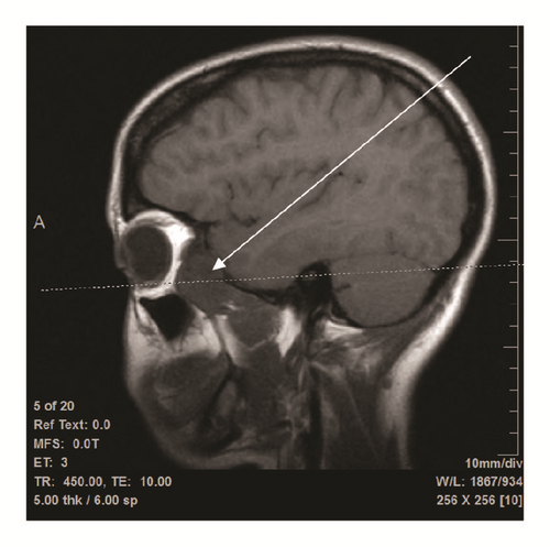 Details are in the caption following the image