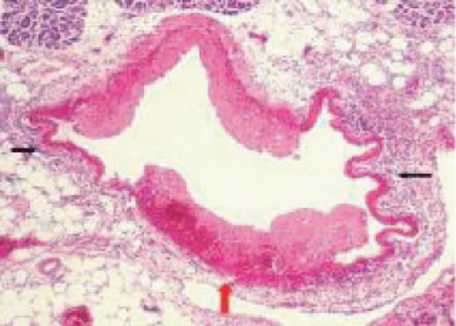 Details are in the caption following the image