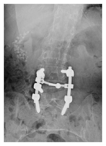 Details are in the caption following the image