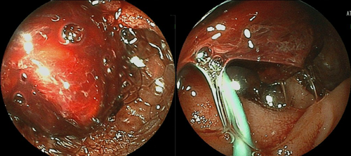 Details are in the caption following the image Details are in the caption following the image