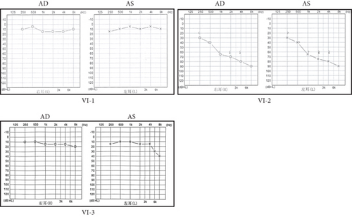 Details are in the caption following the image Details are in the caption following the image