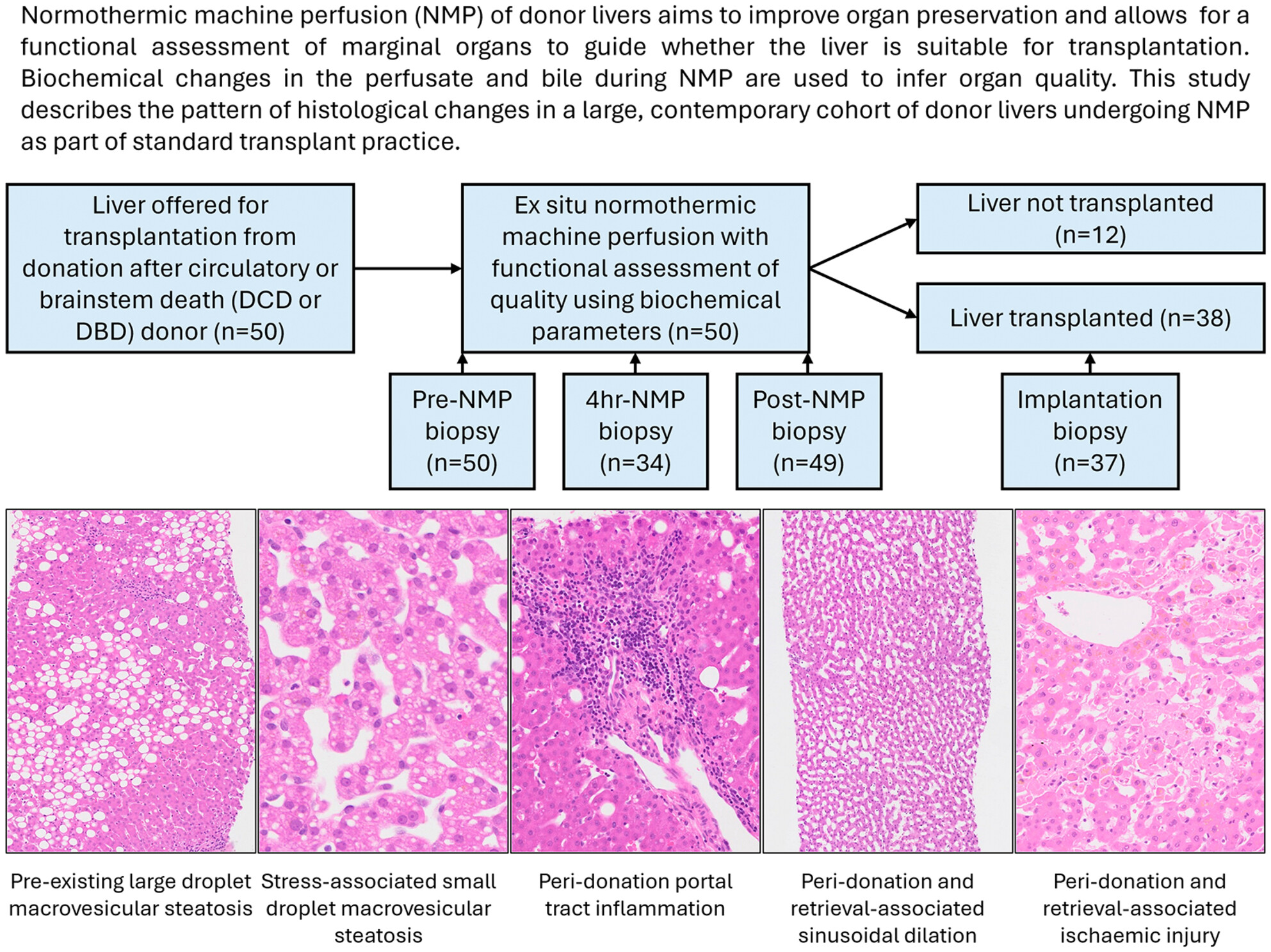 Evolution of morphological changes in donor livers undergoing normothermic machine perfusion