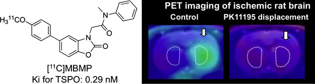 Characterization of a novel acetamidobenzoxazolone-based PET ligand for translocator protein (18 kDa) imaging of neuroinflammation in the brain