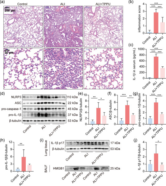 Epoxyeicosatrienoic acids inhibit the activation of NLRP3 inflammasome in murine macrophages