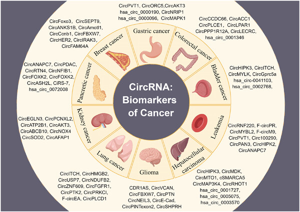 Circular RNAs: Biomarkers of cancer