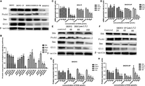 Dihydroartemisinin induces apoptosis and inhibits proliferation, migration, and invasion in epithelial ovarian cancer via inhibition of the hedgehog signaling pathway