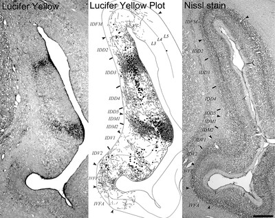Cytoarchitectonic and connection stripes in the dysgranular insular cortex in the macaque monkey