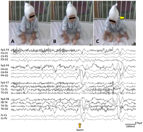 Details are in the caption following the image Details are in the caption following the image