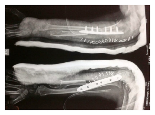 Details are in the caption following the image Details are in the caption following the image