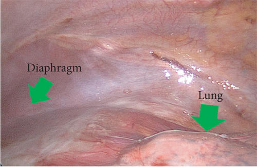Details are in the caption following the image