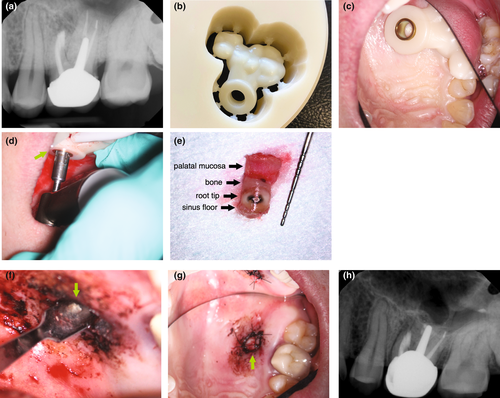 Details are in the caption following the image Details are in the caption following the image