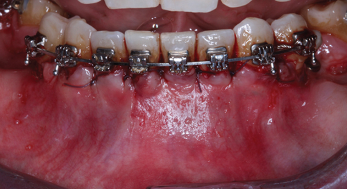Details are in the caption following the image Details are in the caption following the image