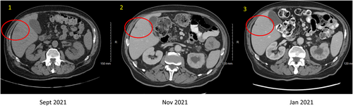 Details are in the caption following the image Details are in the caption following the image