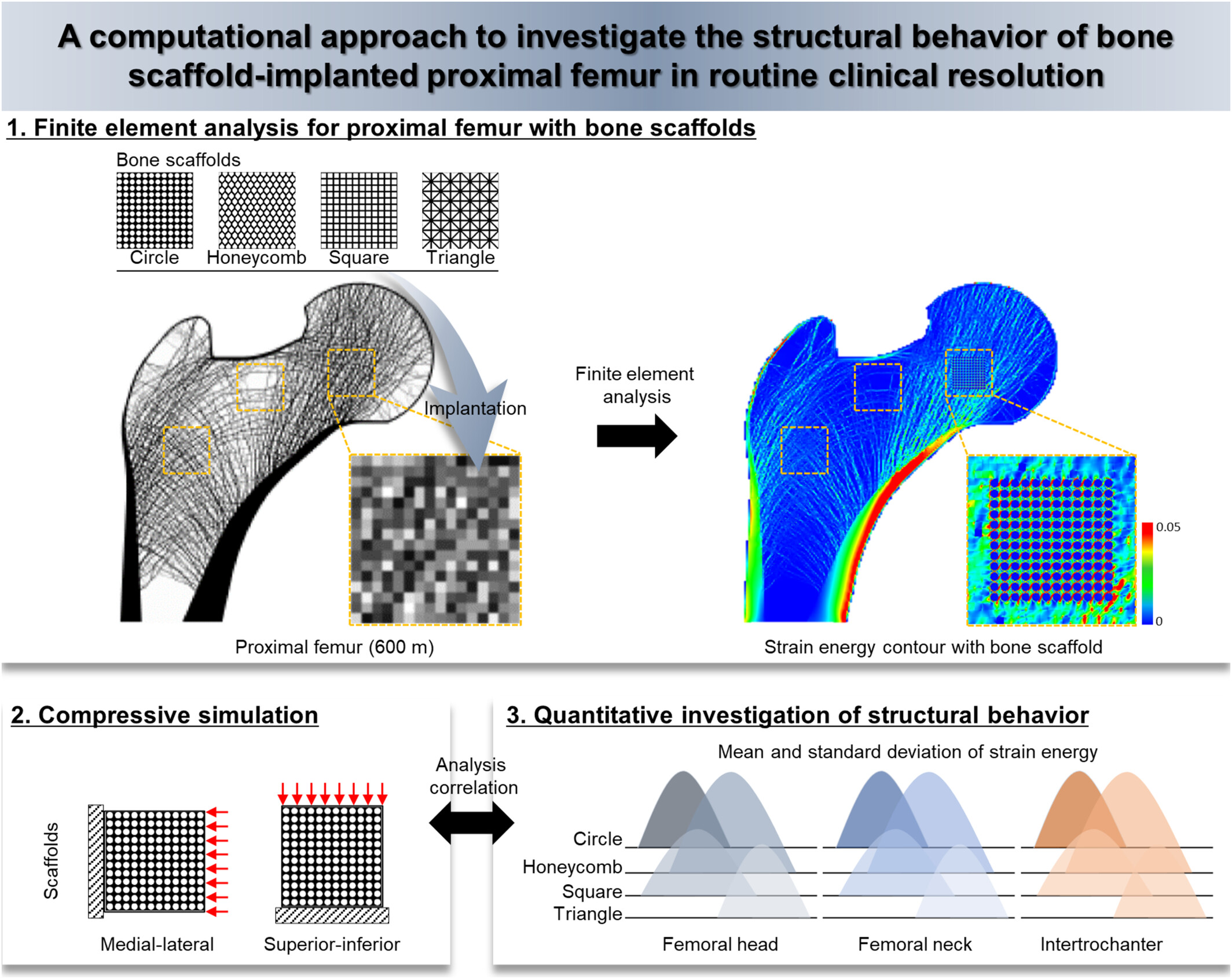 A Computational Approach to Investigate the Structural Behavior of Bone Scaffold-Implanted Proximal Femur in Routine Clinical Resolution Issue 7, 2025