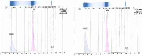 Hemoglobin I-Toulouse: A rare hemoglobinopathy presenting with low oxygen saturations