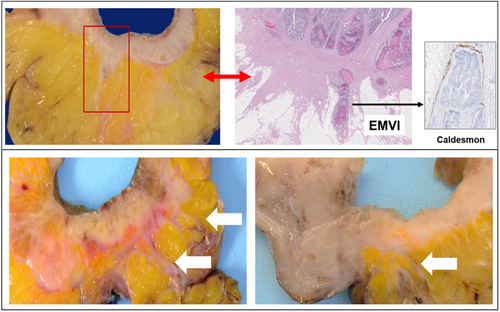 Details are in the caption following the image Details are in the caption following the image