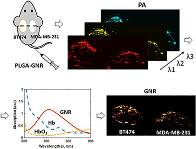 In vivo spectroscopic photoacoustic imaging and laser-induced nanoparticle vaporization for anti-HER2 breast cancer