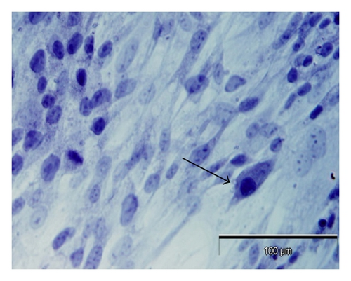 Details are in the caption following the image