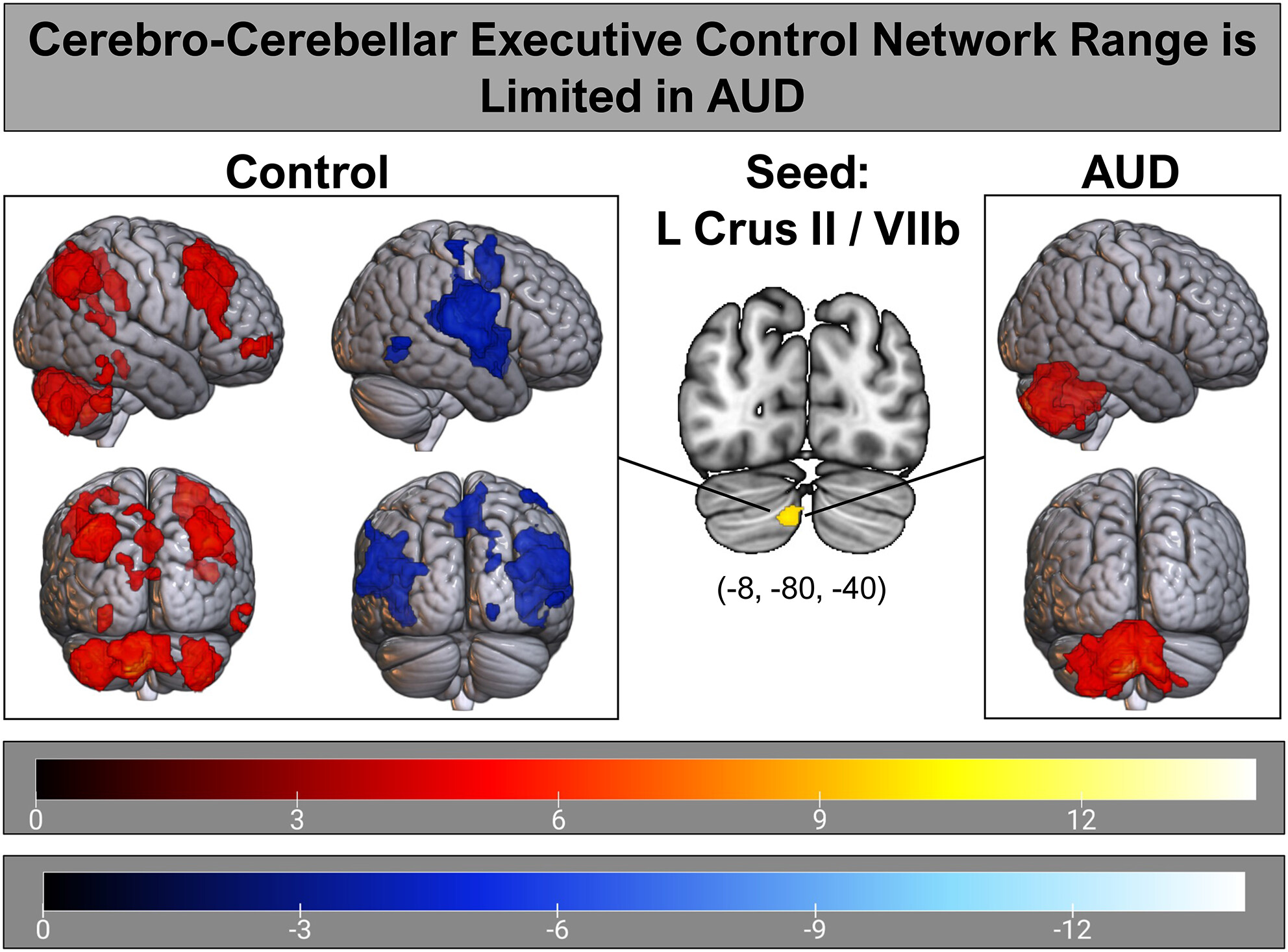Disrupted executive cerebro-cerebellar functional connectivity in alcohol use disorder