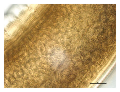 Details are in the caption following the image
