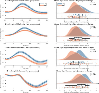 The role of hippocampal theta oscillations in working memory impairment in multiple sclerosis