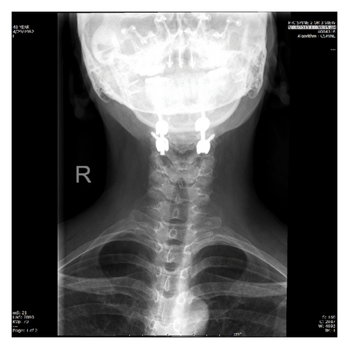 Details are in the caption following the image Details are in the caption following the image