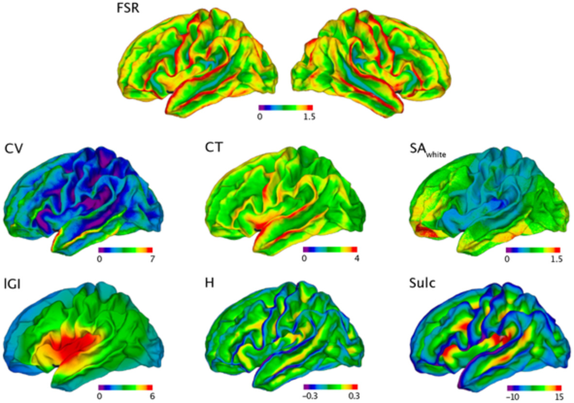 Examining volumetric gradients based on the frustum surface ratio in the brain in autism spectrum disorder