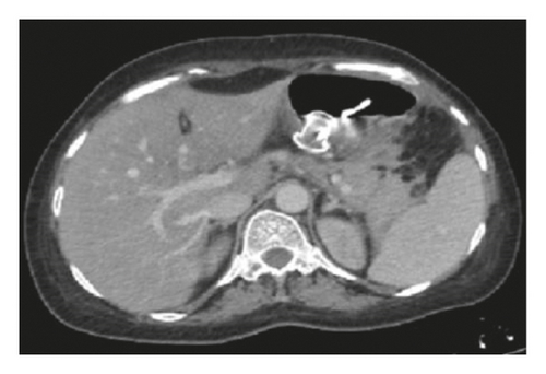 Details are in the caption following the image