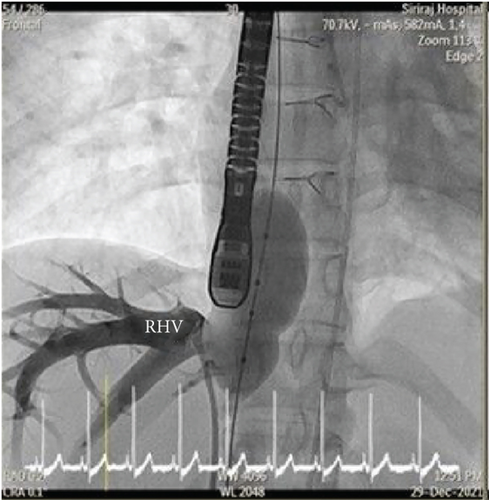 Details are in the caption following the image Details are in the caption following the image