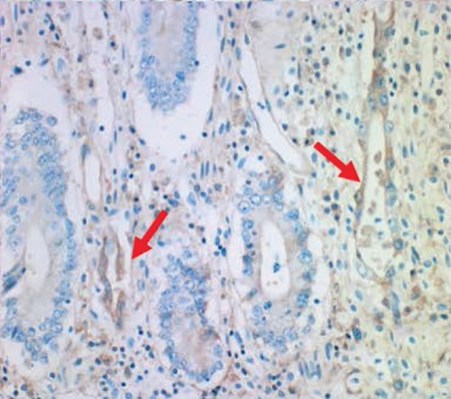 Details are in the caption following the image
