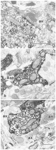 Details are in the caption following the image