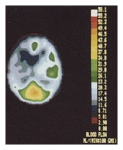 Details are in the caption following the image