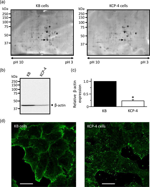 Impaired actin filaments decrease cisplatin sensitivity via dysfunction of volume-sensitive Cl− channels in human epidermoid carcinoma cells