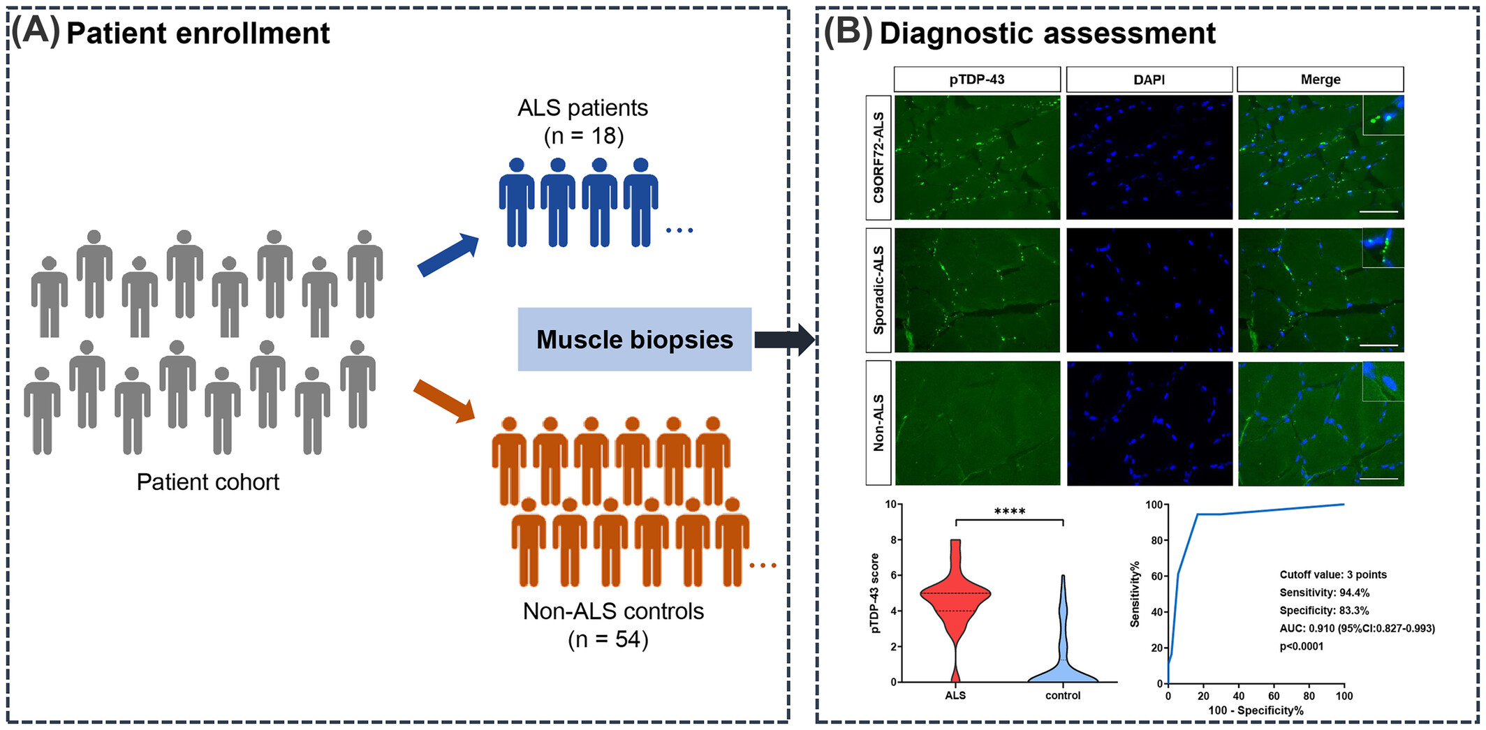 Detection of pTDP-43 via routine muscle biopsy: A promising diagnostic biomarker for amyotrophic lateral sclerosis