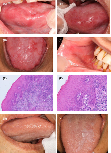 Details are in the caption following the image Details are in the caption following the image