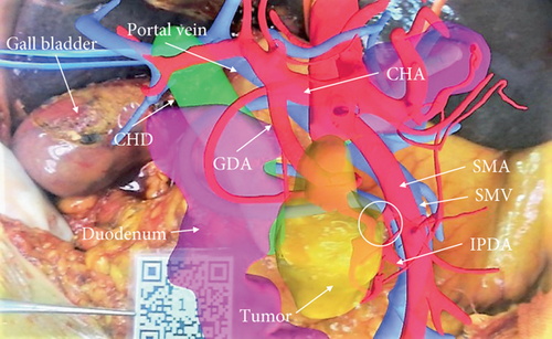 Details are in the caption following the image