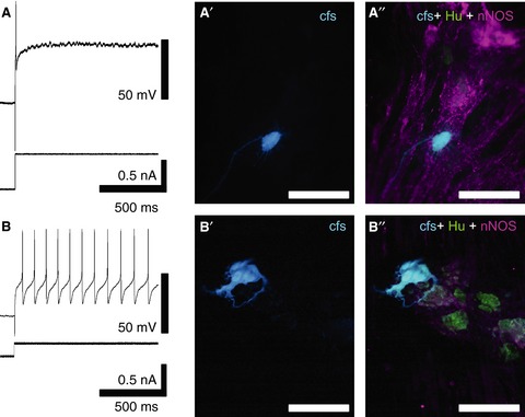 Electrophysiological and morphological changes in colonic myenteric neurons from chemotherapy-treated patients: a pilot study
