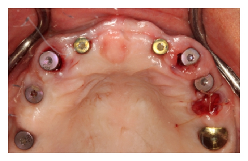 Details are in the caption following the image Details are in the caption following the image