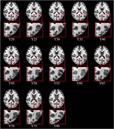 An artificial-intelligence-based age-specific template construction framework for brain structural analysis using magnetic resonance images