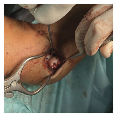 Details are in the caption following the image Details are in the caption following the image