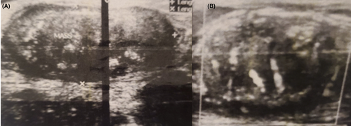 Details are in the caption following the image