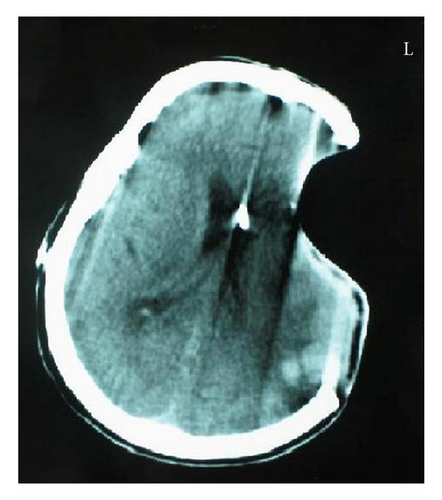 Details are in the caption following the image Details are in the caption following the image