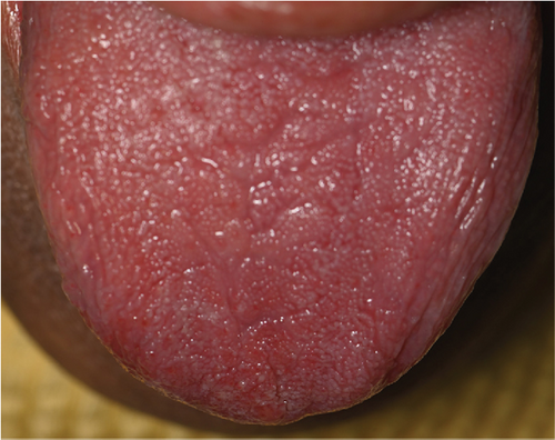 Details are in the caption following the image Details are in the caption following the image