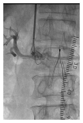 Details are in the caption following the image