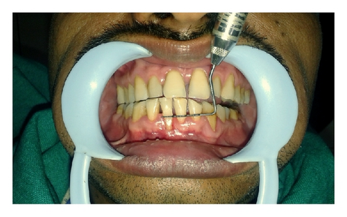 Details are in the caption following the image Details are in the caption following the image