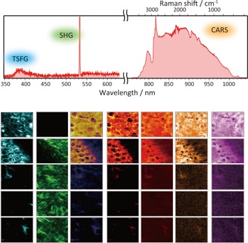 Multimodal and multiplex spectral imaging of rat cornea ex vivo using a white-light laser source
